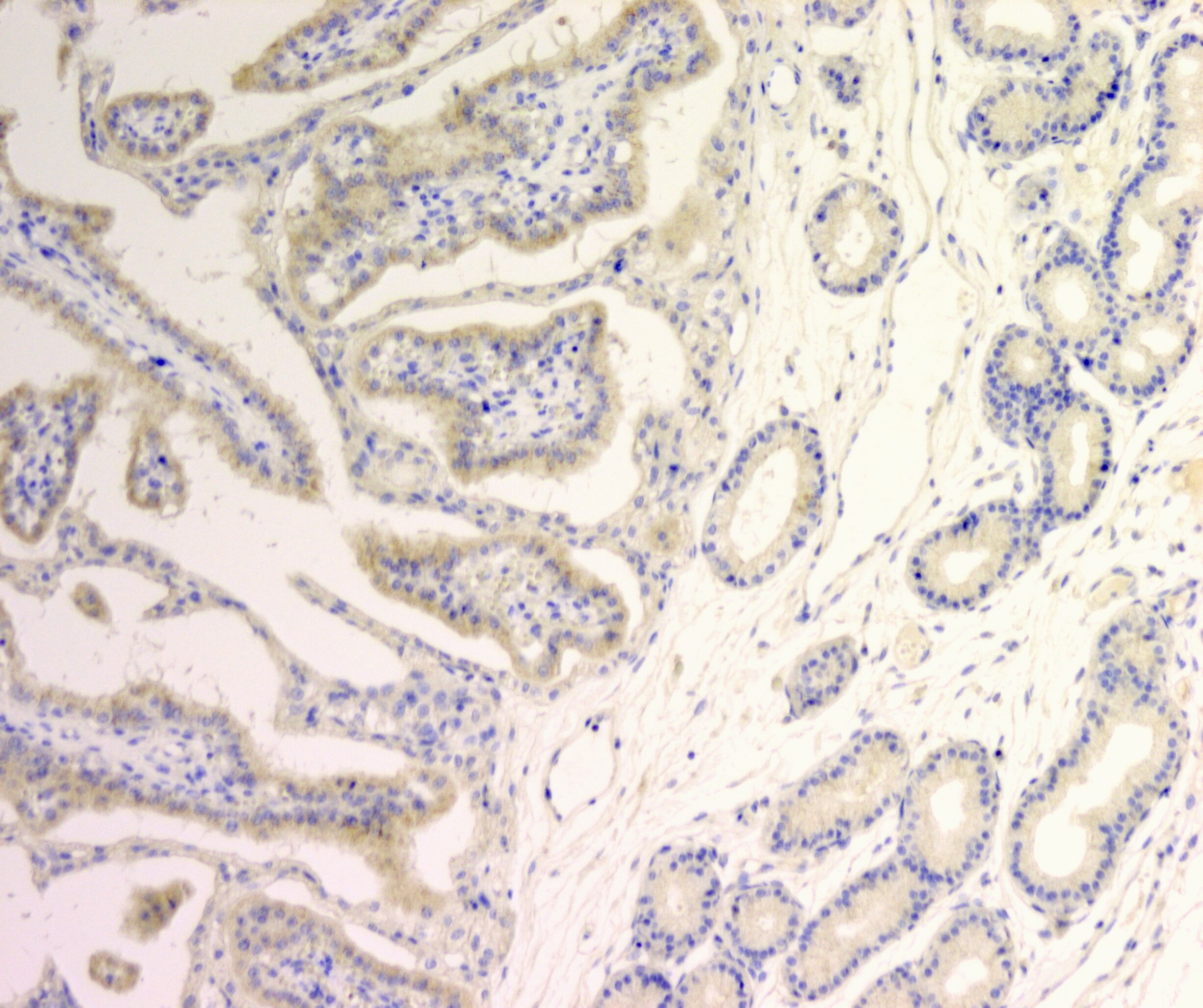 SLC39A2/ZIP2 Antibody - BSA Free NBP1-76499