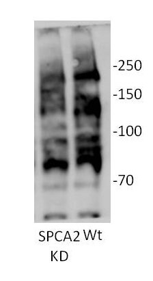 ATP2C2 Antibody - BSA Free NBP1-76567