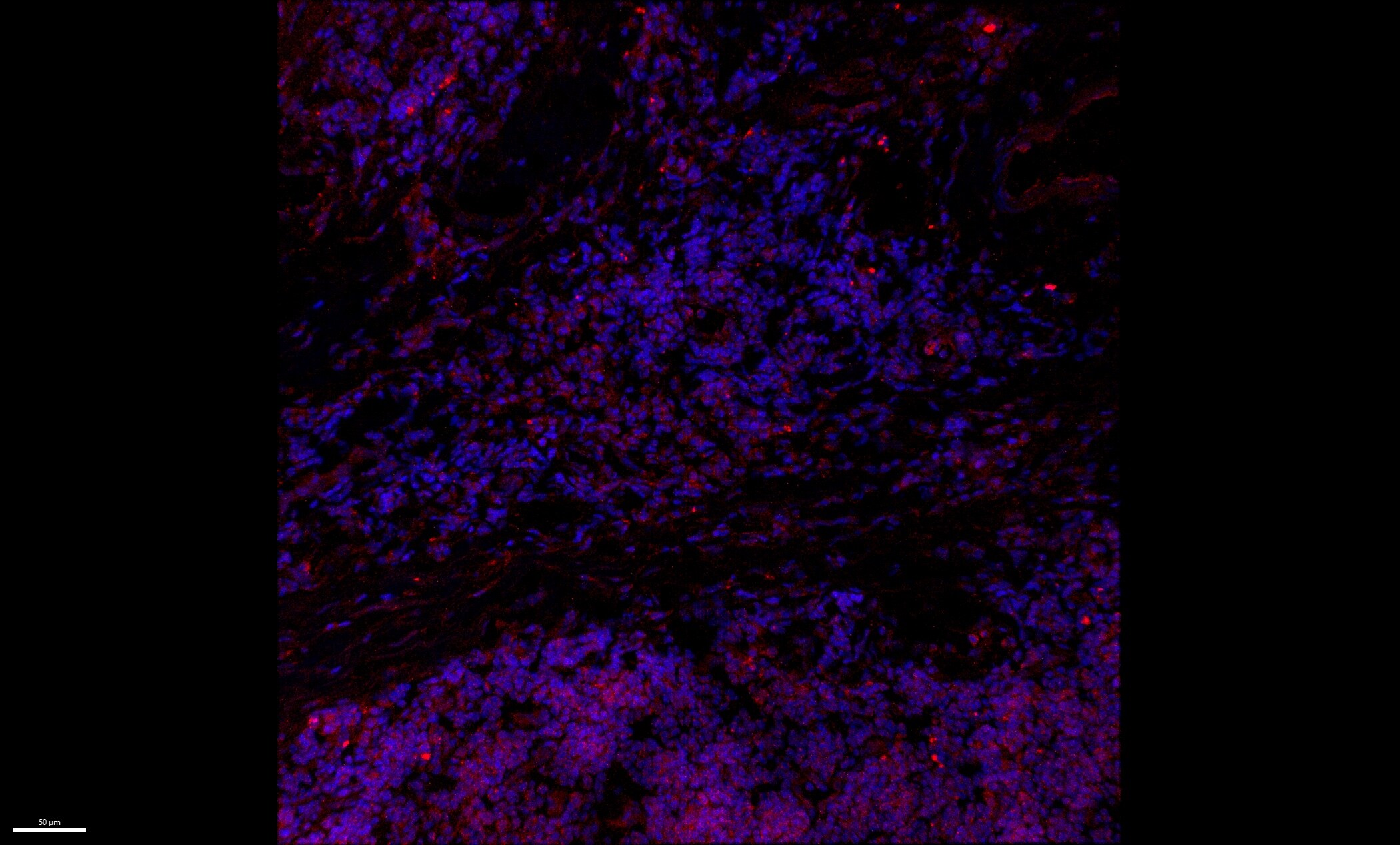 IL-32 Antibody - BSA Free NBP1-76684