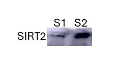 Sirtuin 2/SIRT2 Antibody - BSA Free NBP1-76879