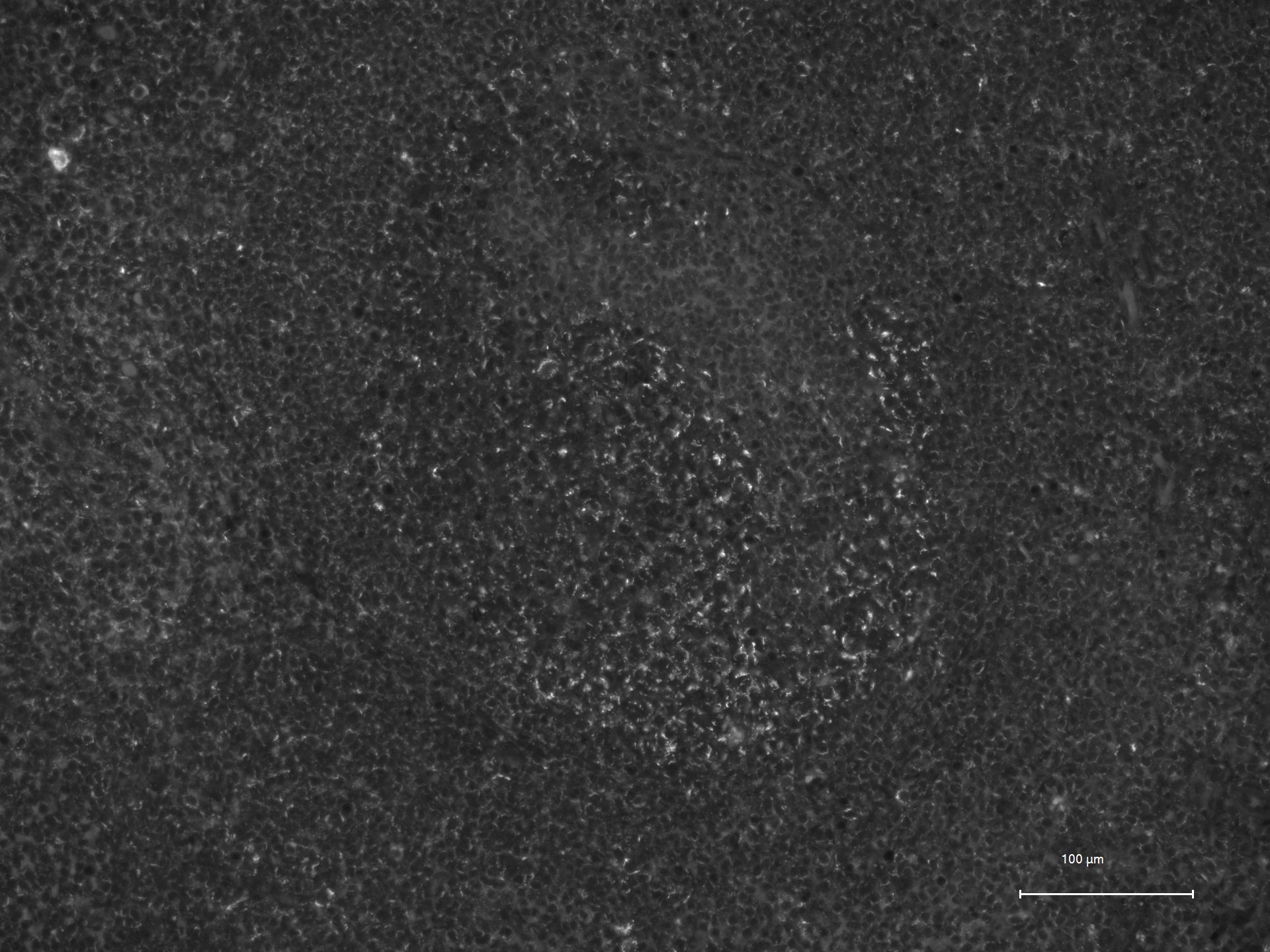 CX3CR1 Antibody - BSA Free NBP1-76949