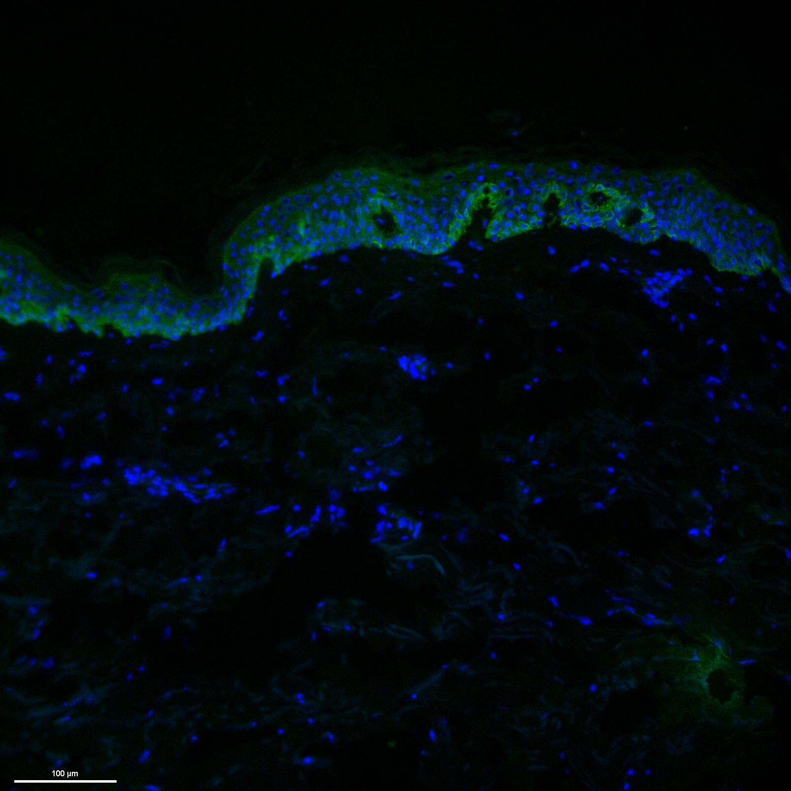 ADAM10 Antibody - BSA Free NBP1-76973