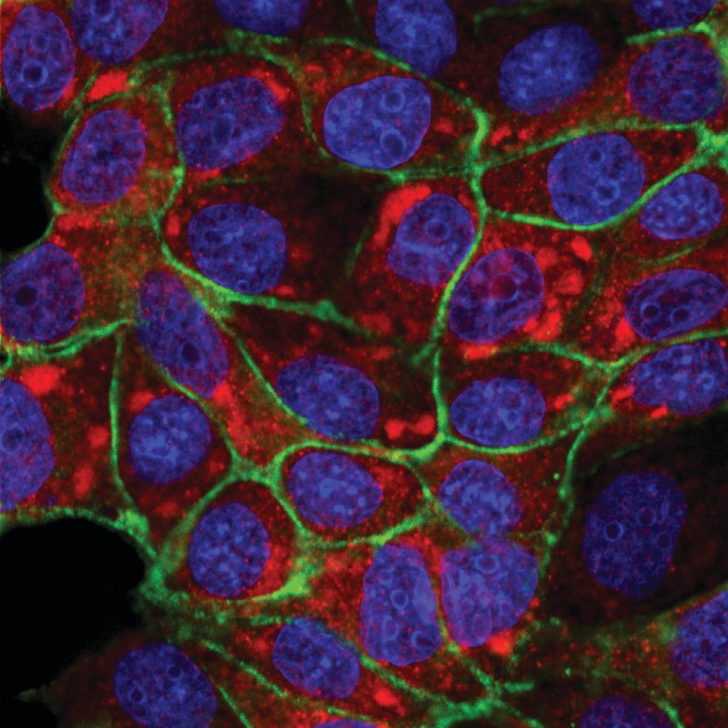 PIEZO1 Antibody - BSA Free NBP1-78446
