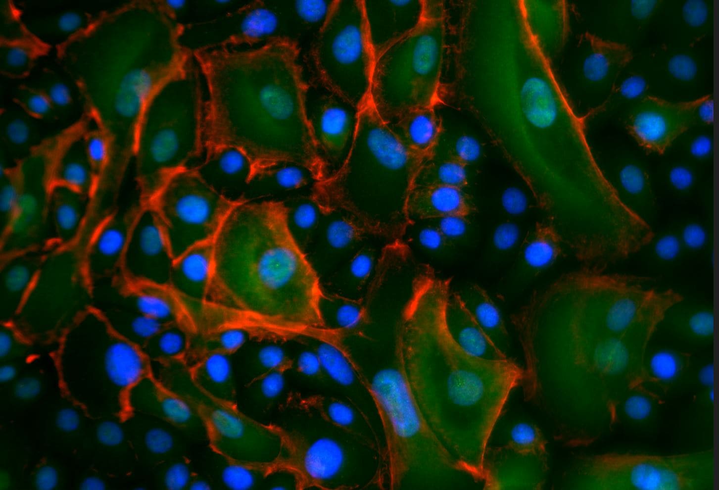 PIEZO1 Antibody - BSA Free NBP1-78537