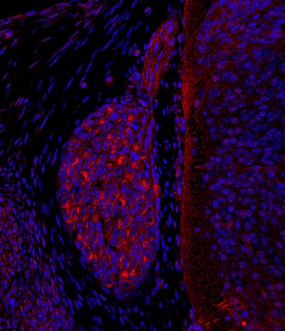 PIEZO2 Antibody - BSA Free NBP1-78624
