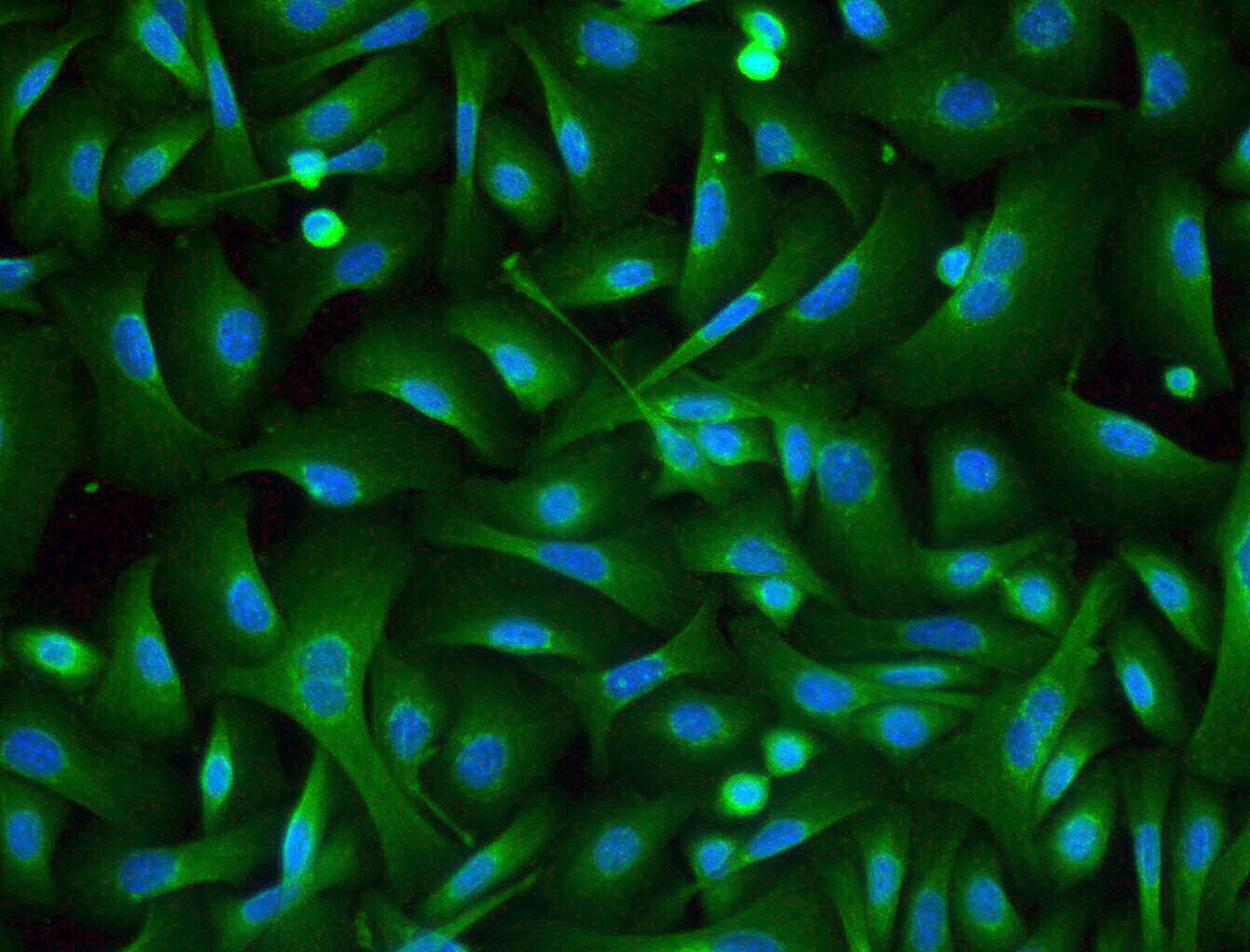 Desmoglein-3 Antibody (5H10) - BSA Free NBP1-78984