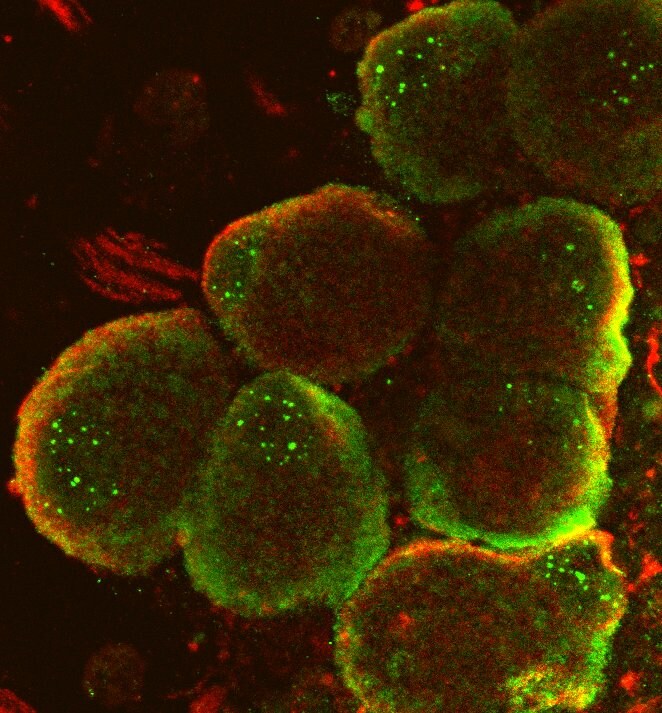 RAB35 Antibody - BSA Free NBP1-79484