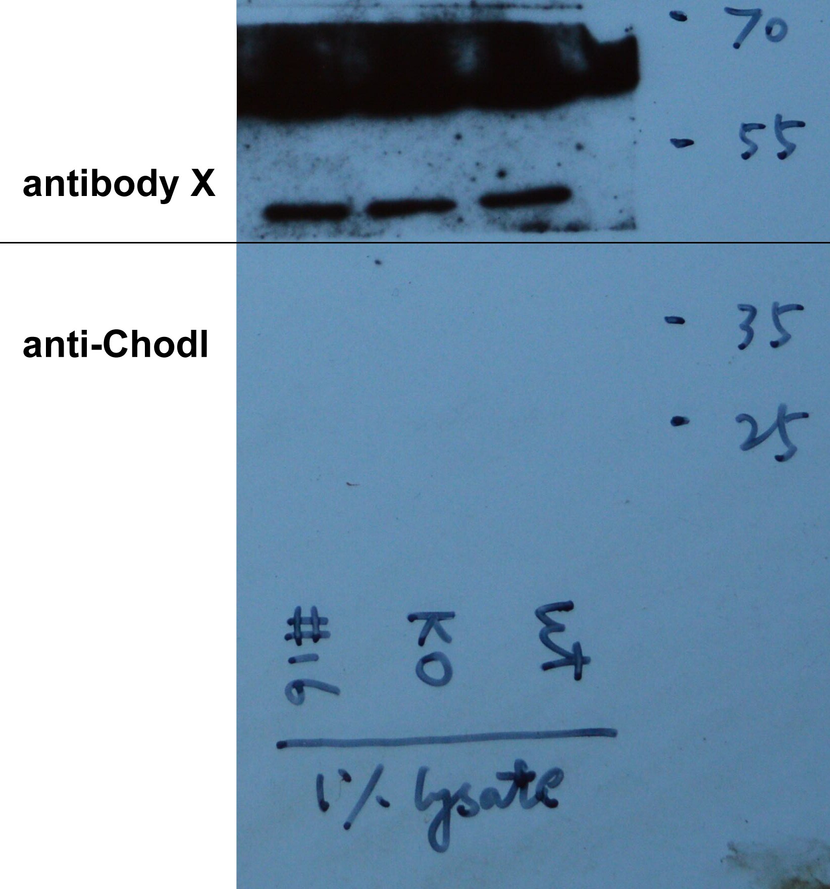 Chondrolectin Antibody - BSA Free NBP1-79543