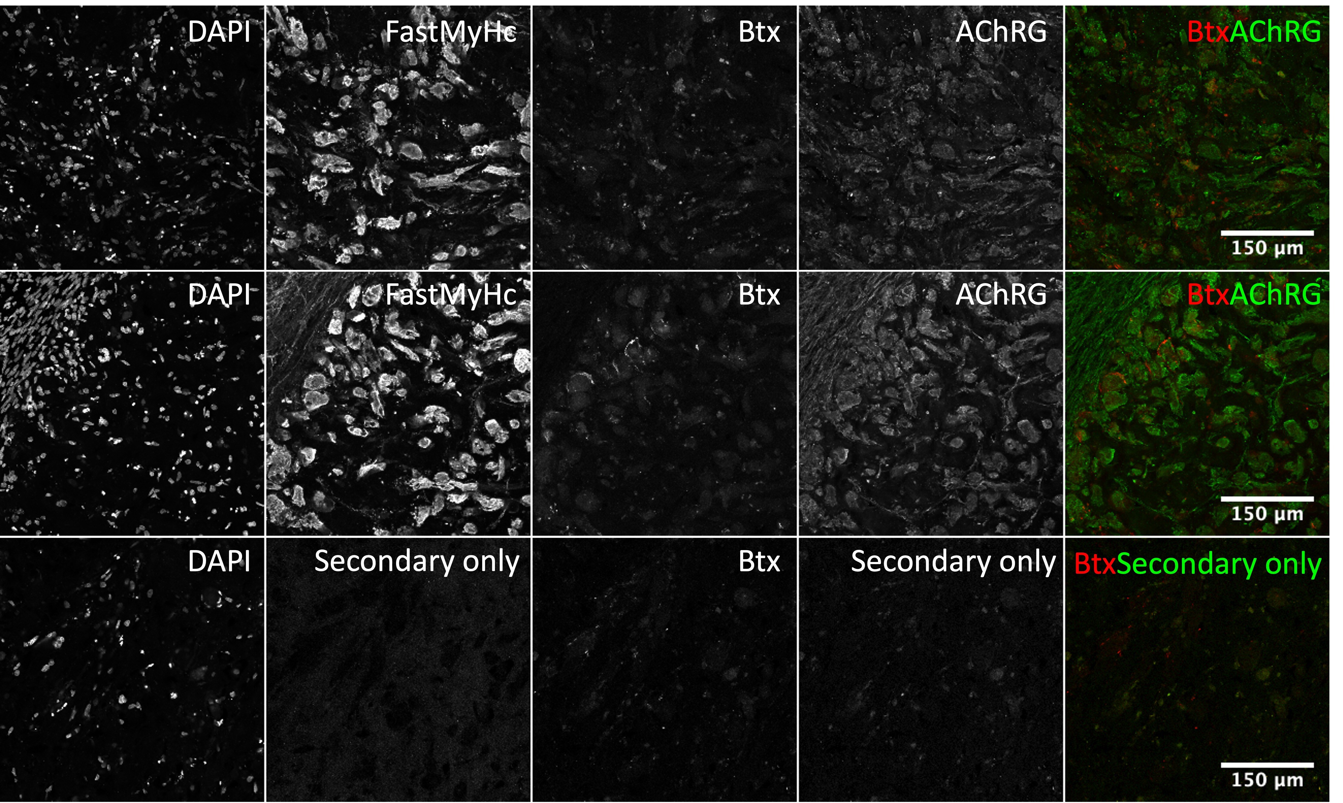 Nicotinic Acetylcholine Receptor gamma Antibody - BSA Free NBP1-79952