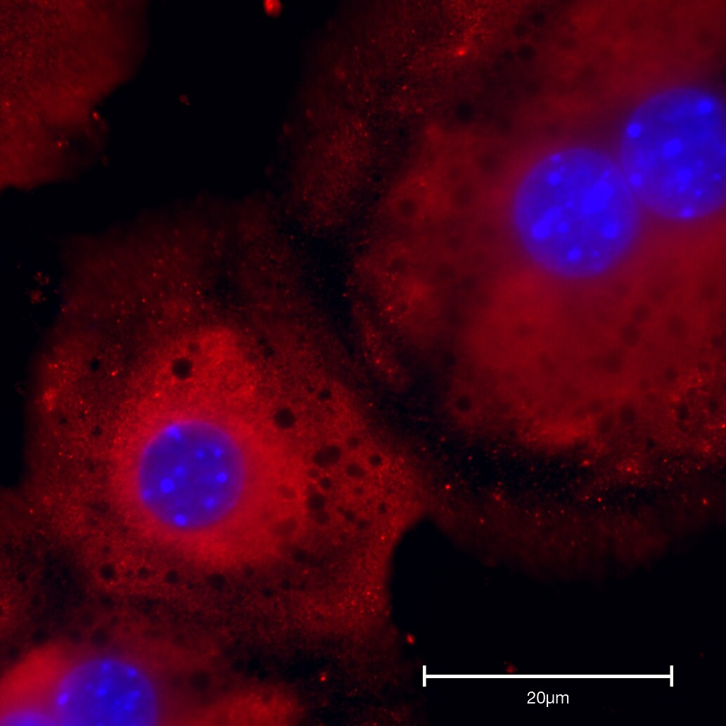 TGF-beta 1 Antibody - BSA Free NBP1-80289