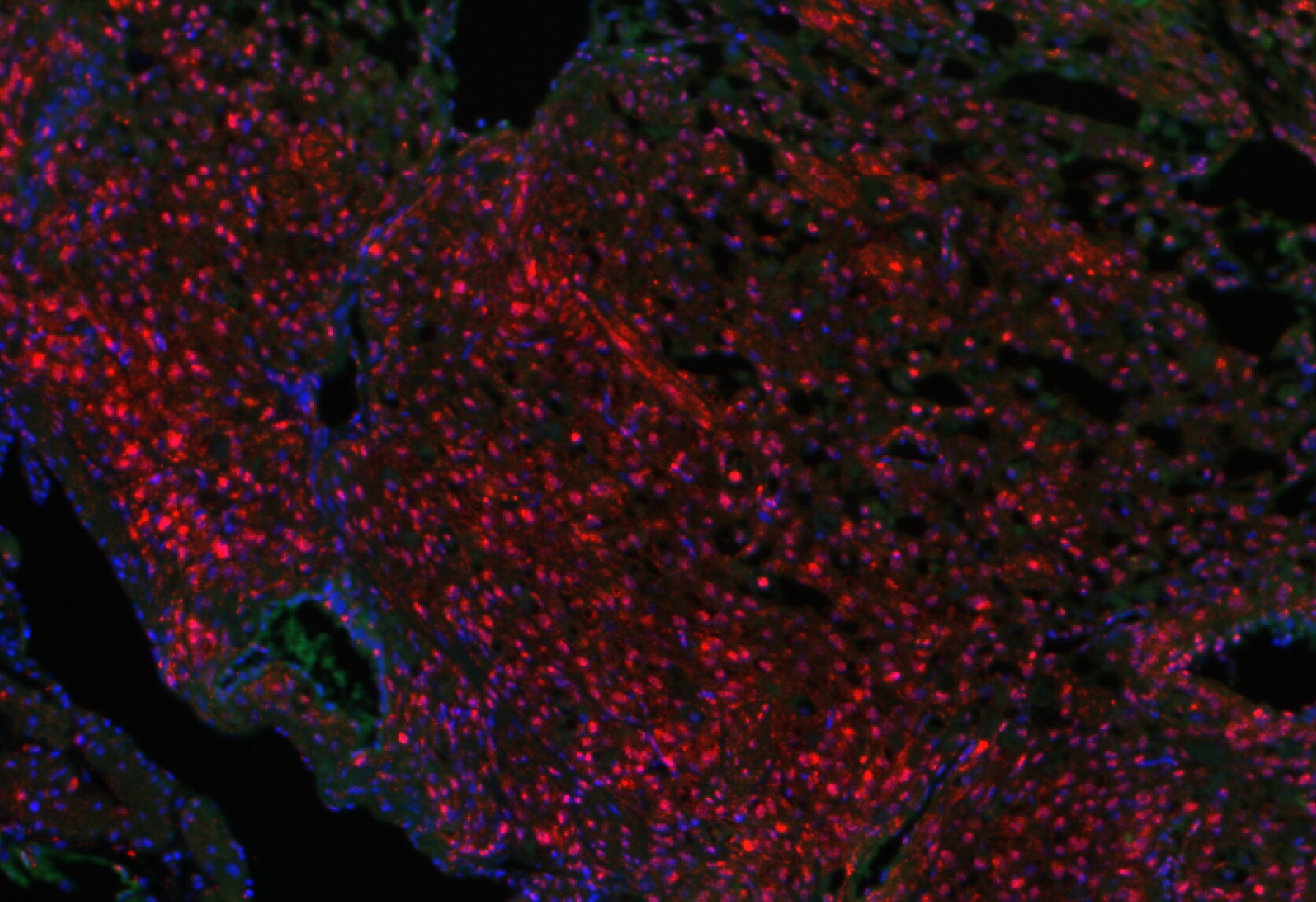 KDM6A Antibody - BSA Free NBP1-80628