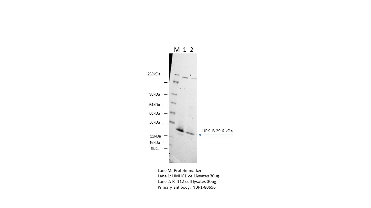 Uroplakin Ib Antibody - BSA Free NBP1-80656