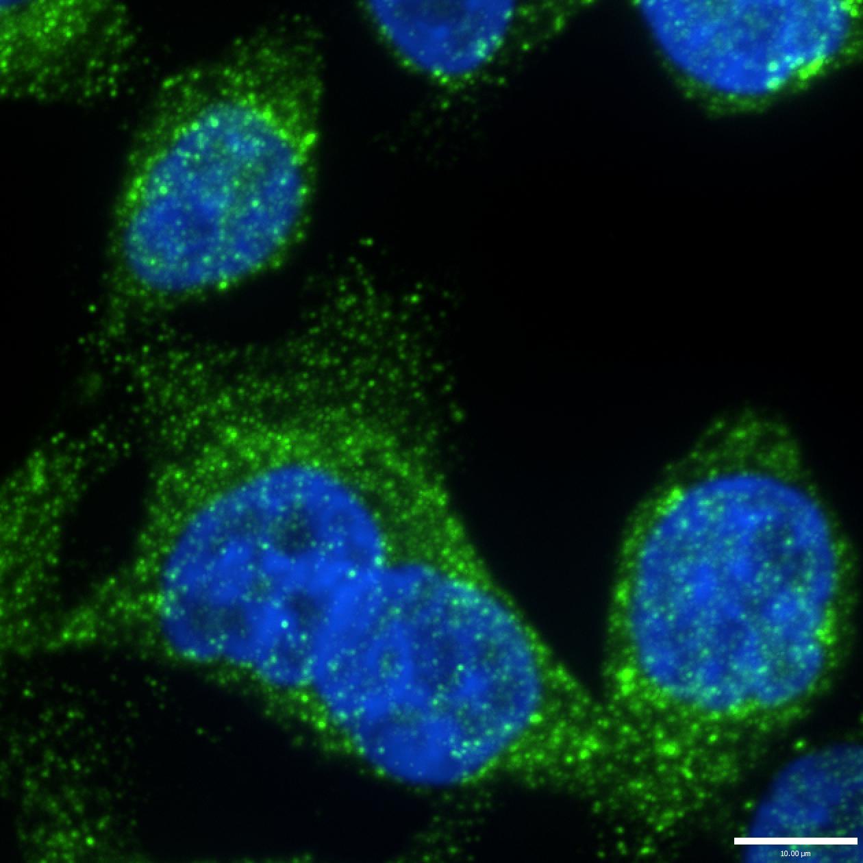 OSBPL7 Antibody NBP1-81054