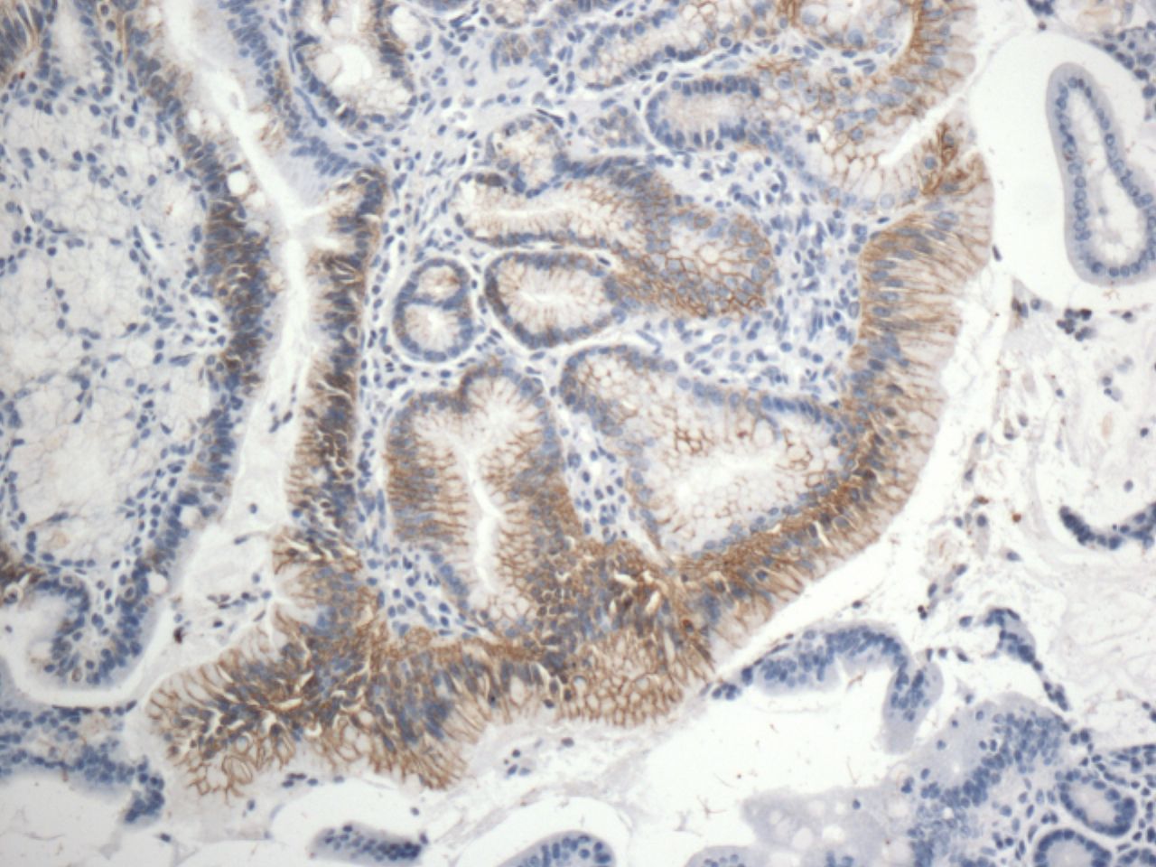 VSIG1 Antibody - BSA Free NBP1-81074
