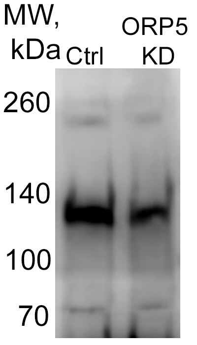 OSBPL5 Antibody - BSA Free NBP1-81403