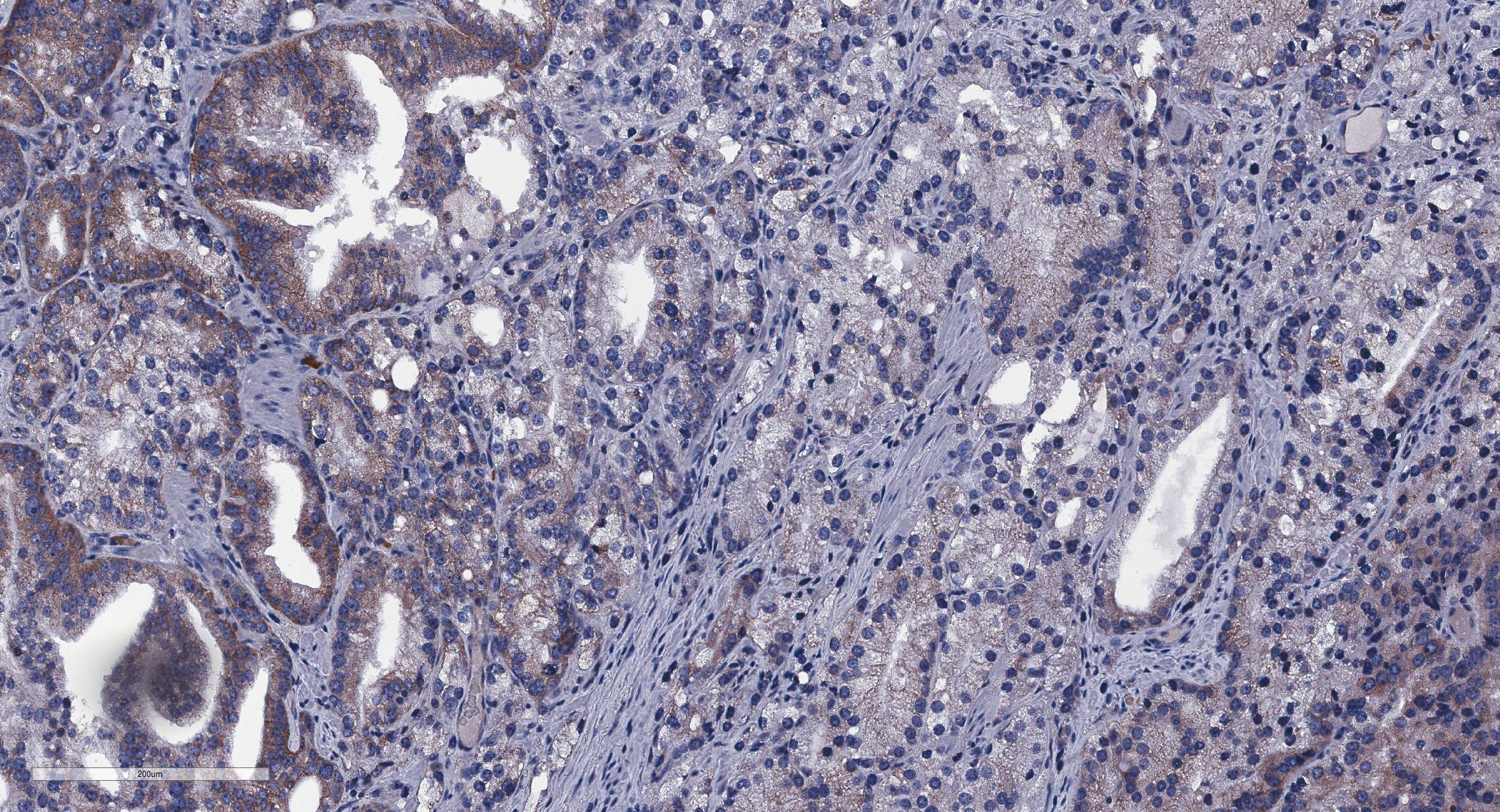 OSBPL5 Antibody - BSA Free NBP1-81403