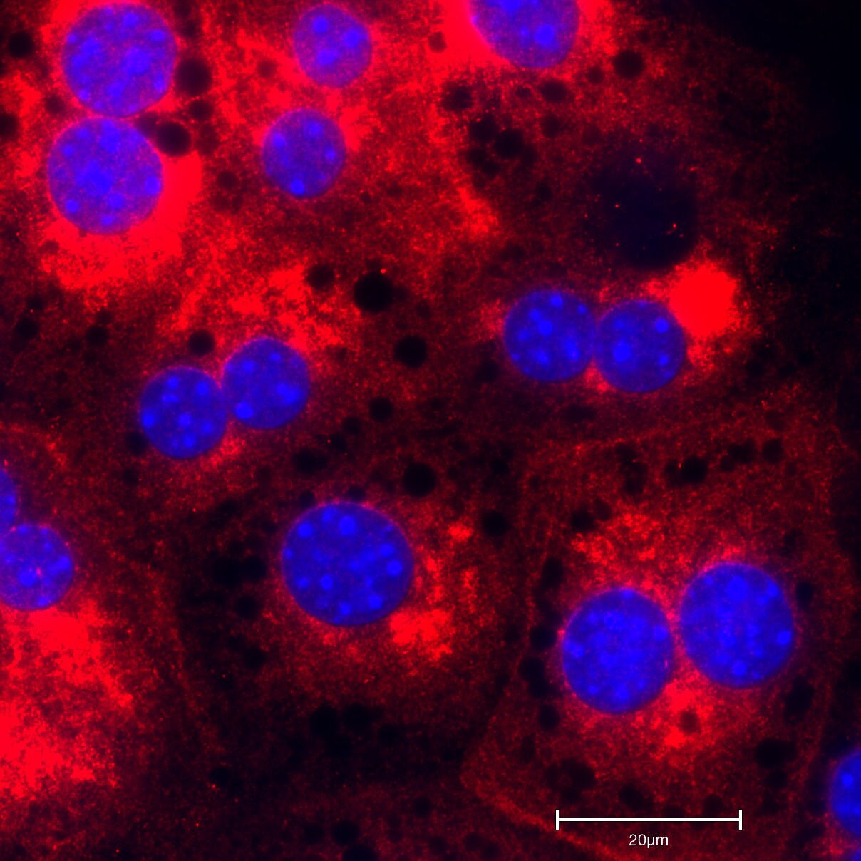 OSBPL5 Antibody - BSA Free NBP1-81403