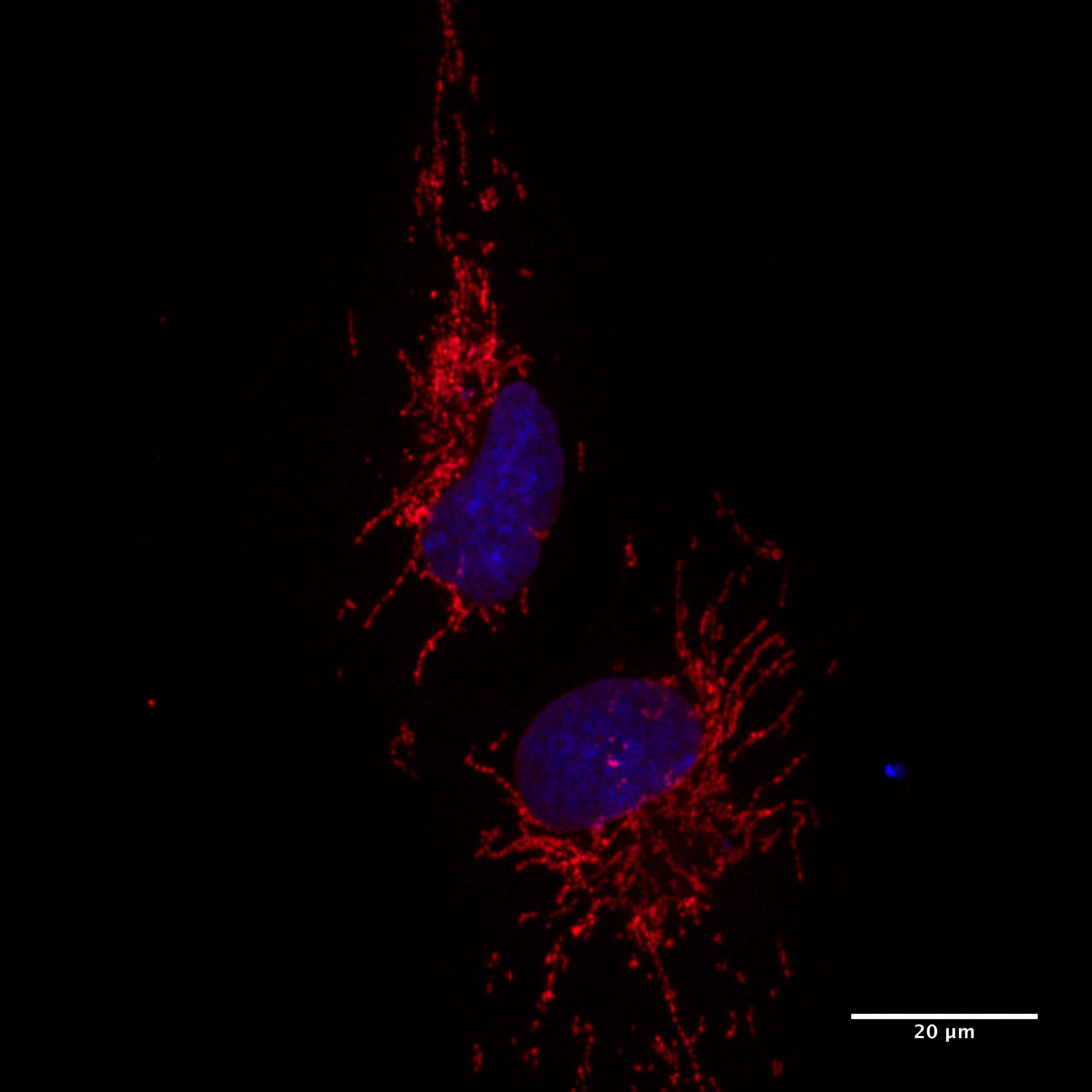 TOMM20 Antibody - BSA Free NBP1-81556