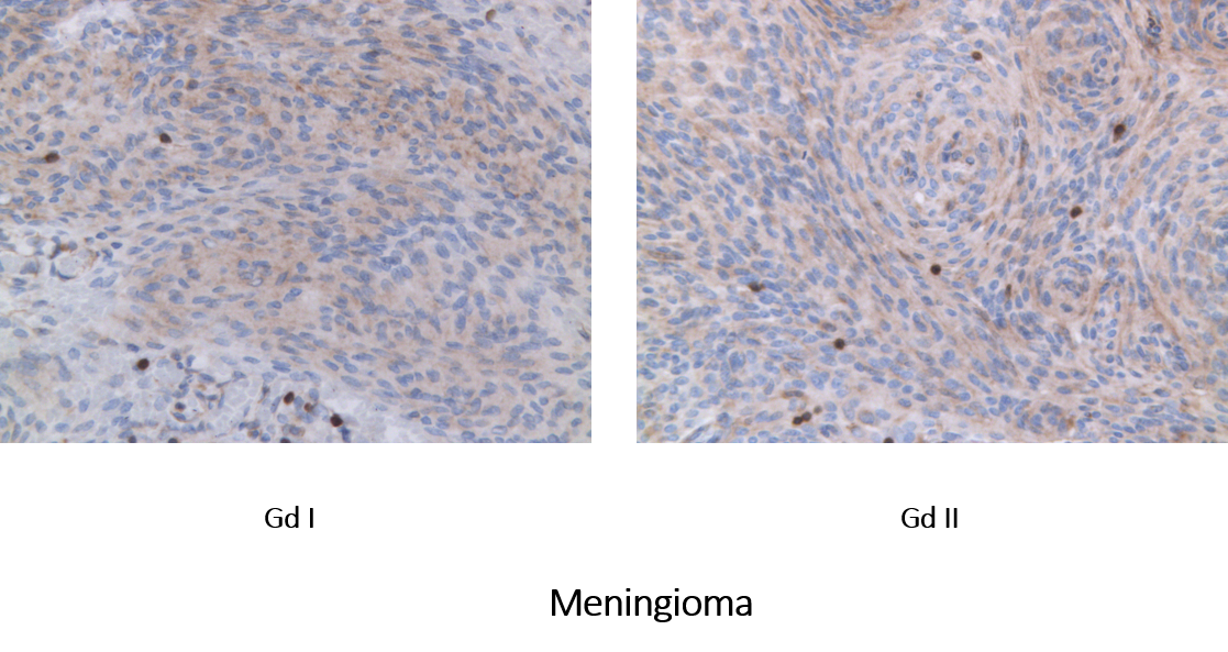 PTPN7 Antibody - BSA Free NBP1-81756