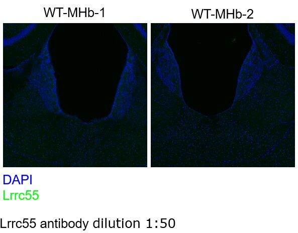 LRRC55 Antibody - BSA Free NBP1-81890