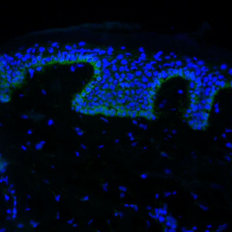 CCL7/MCP-3/MARC Antibody - BSA Free NBP1-82367