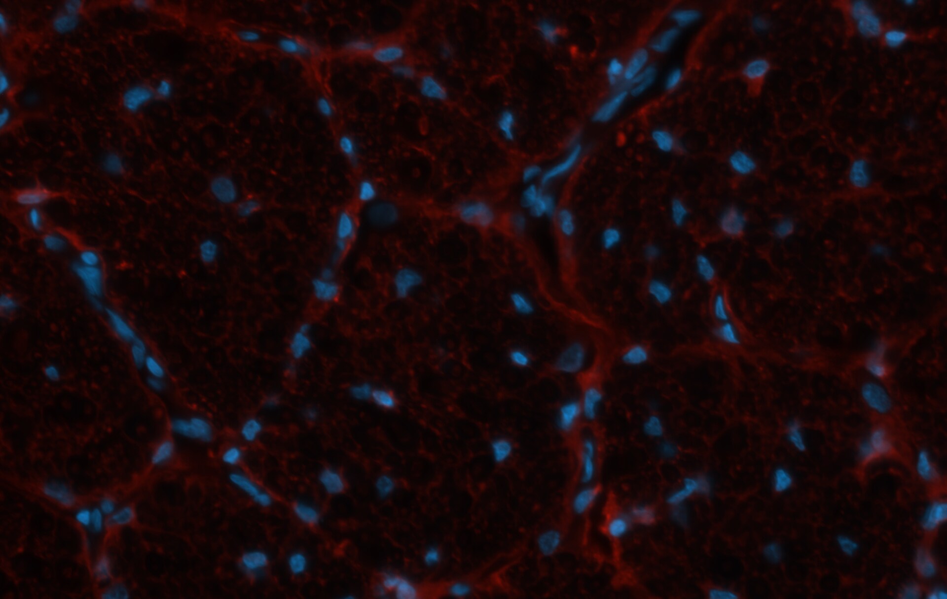 NKX2.2 Antibody - BSA Free NBP1-82554