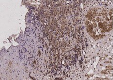 PHF1 Antibody - BSA Free NBP1-82613