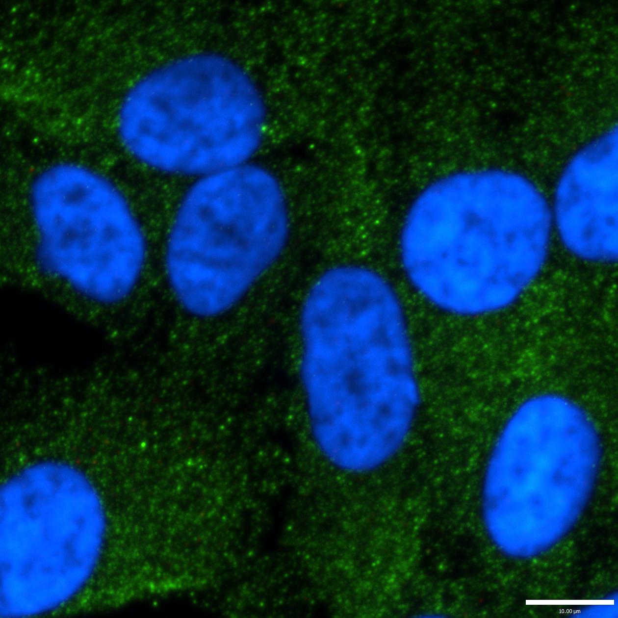 OSBPL3 Antibody - BSA Free NBP1-82968