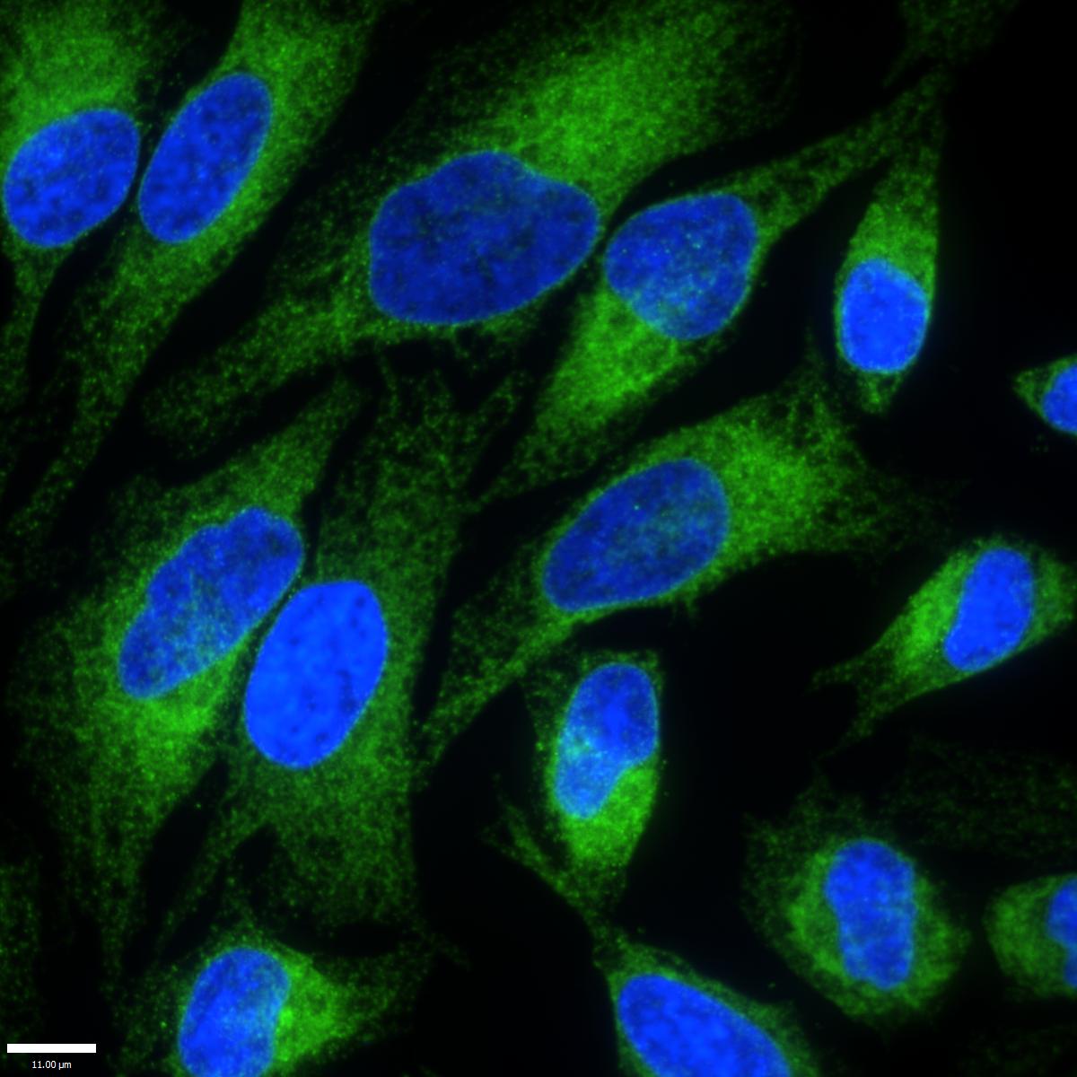 VAP-A Antibody - BSA Free NBP1-83132
