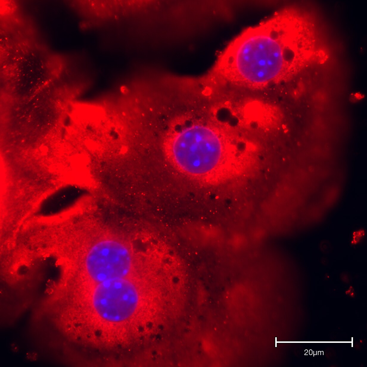 N-Acetylglucosaminyltransferase V/MGAT5 Antibody - BSA Free NBP1-83354