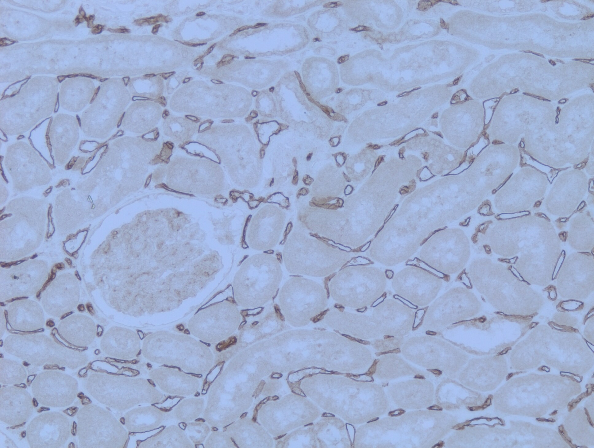 PLVAP Antibody - BSA Free NBP1-83911
