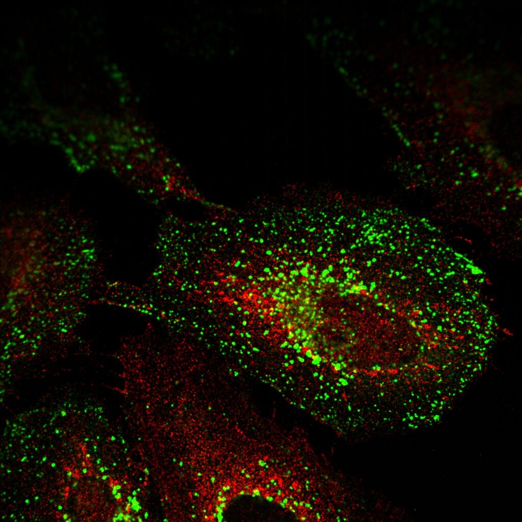 Niemann-Pick type C2 Antibody - BSA Free NBP1-84012