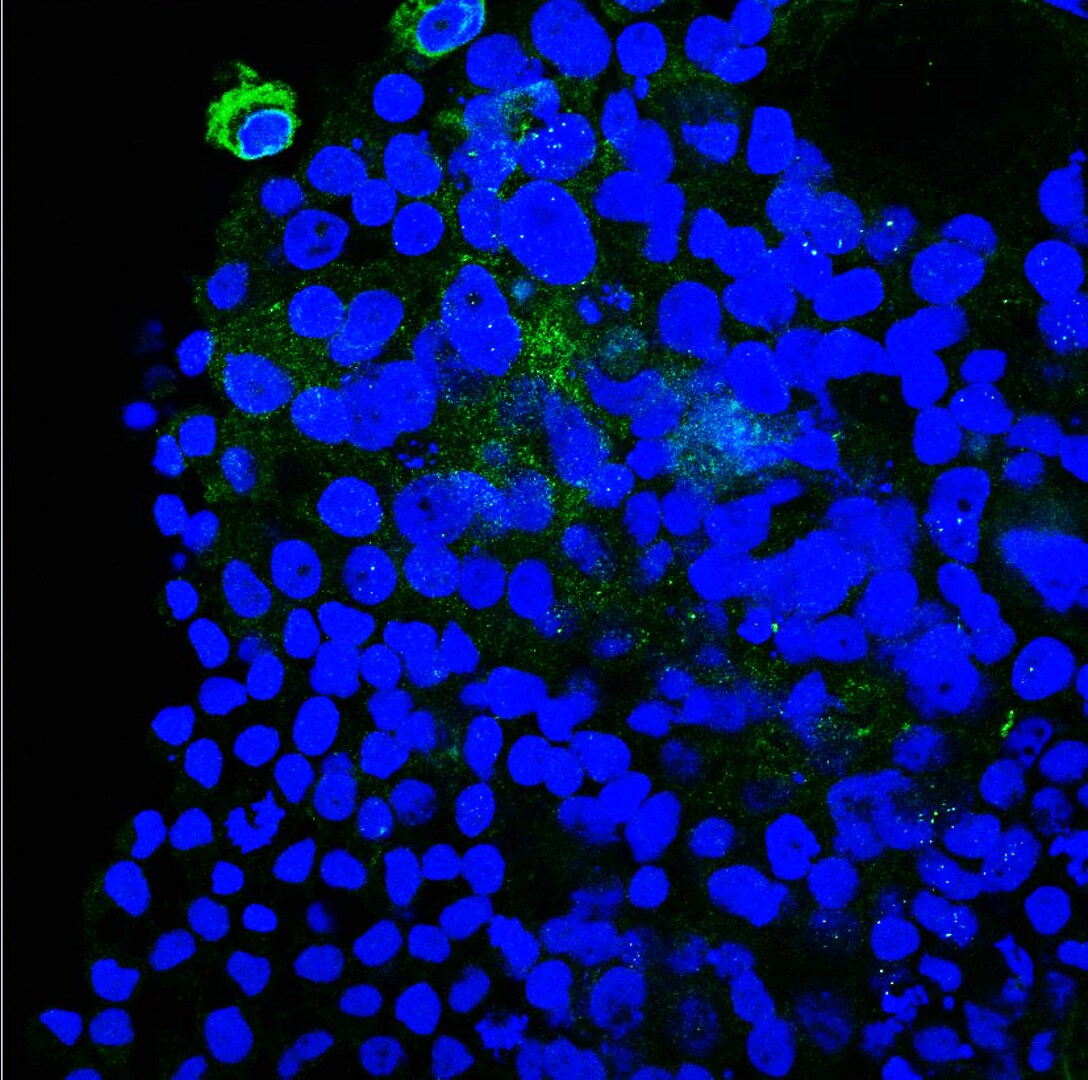 Plectin Antibody - BSA Free NBP1-84020