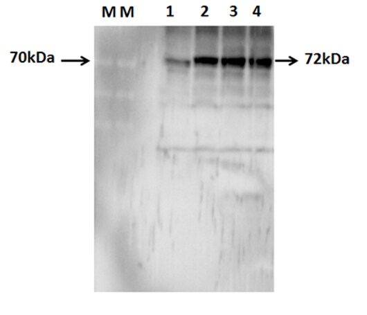 Optineurin Antibody - BSA Free NBP1-84682