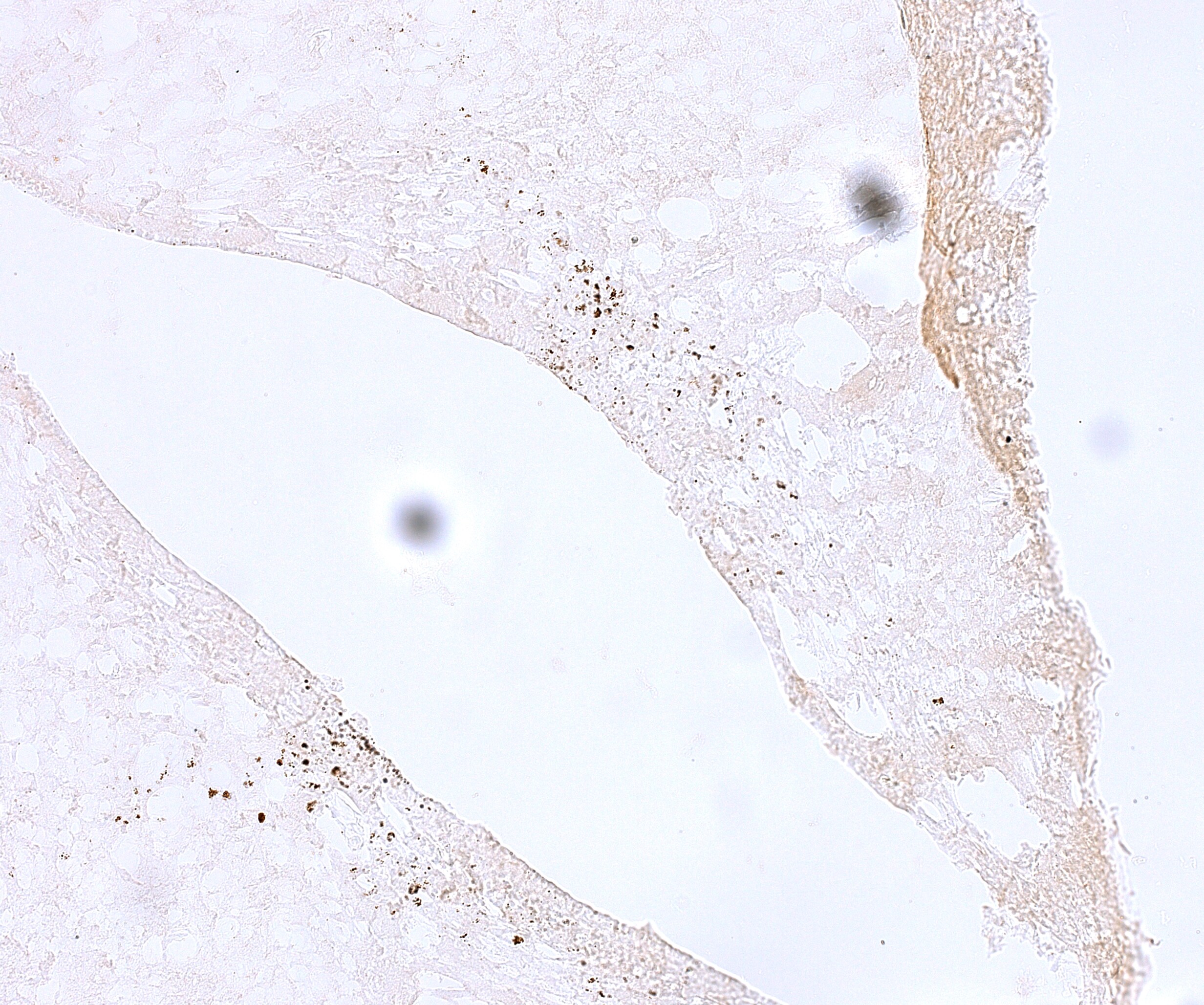 Rev-erb A alpha/NR1D1 Antibody - BSA Free NBP1-84931