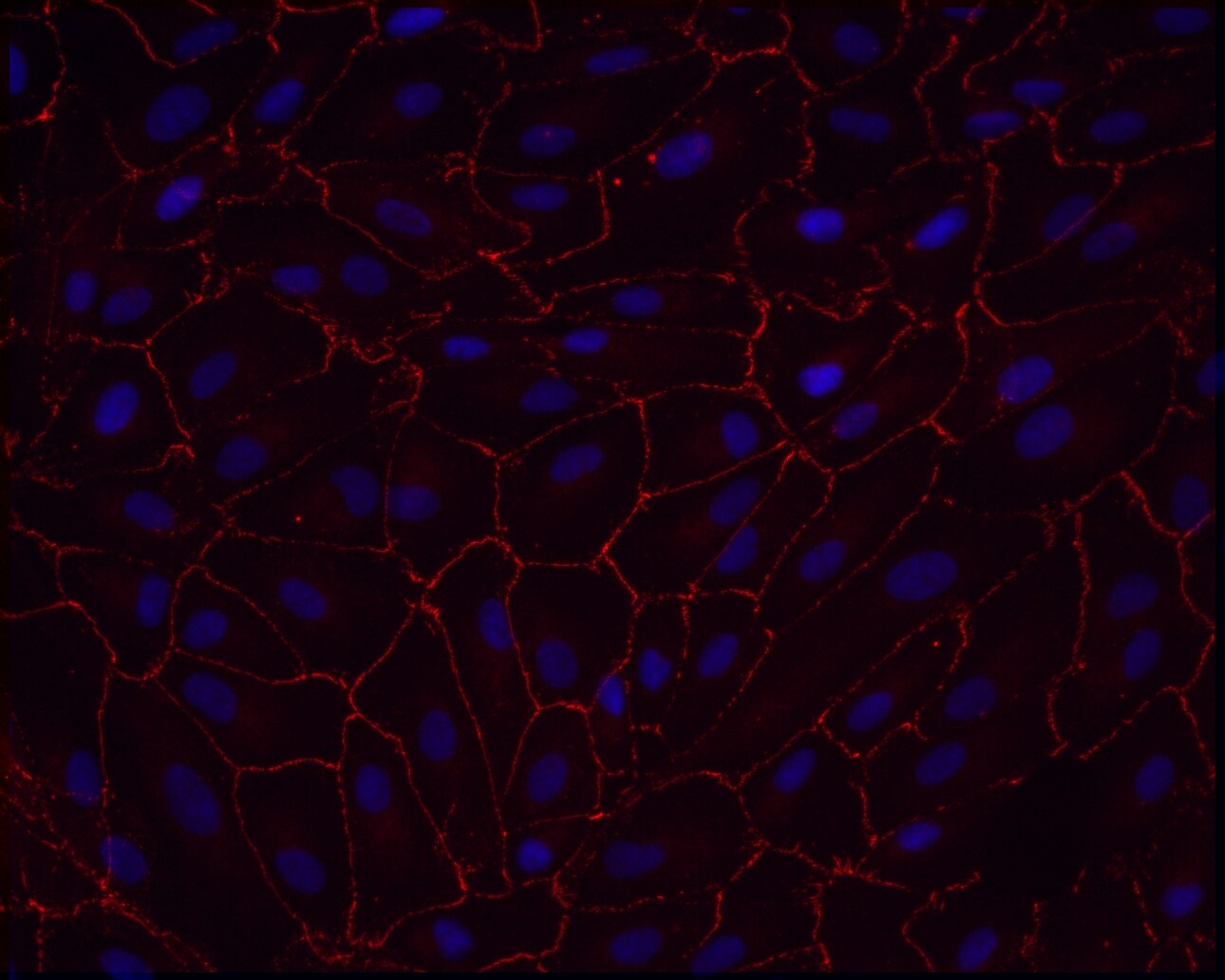 Tight Junction Protein 1 Antibody - BSA Free NBP1-85047