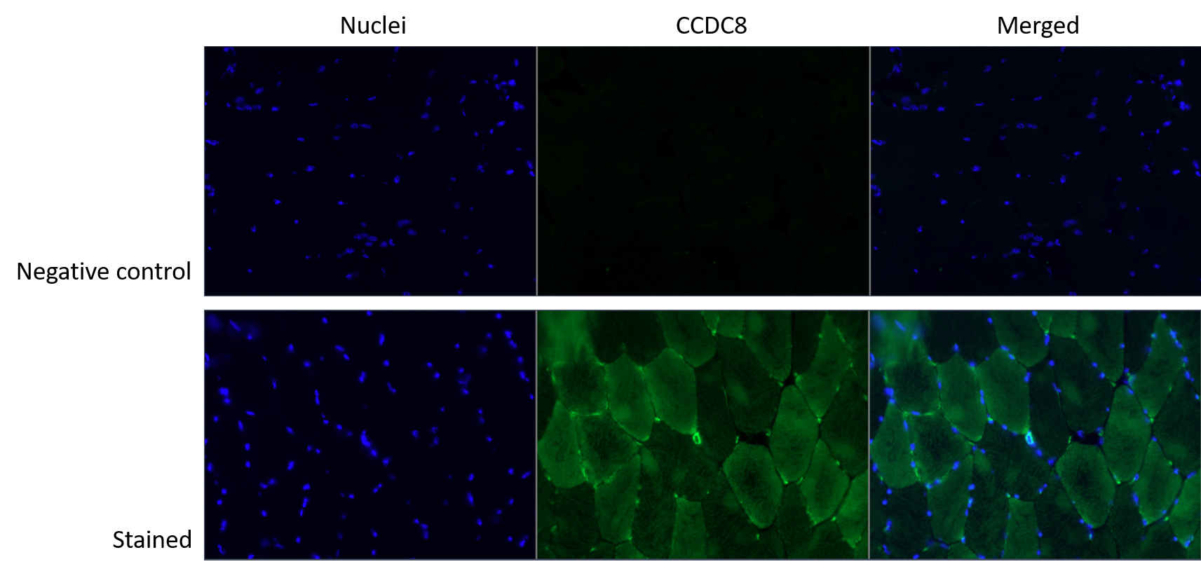 CCDC8 Antibody - BSA Free NBP1-85085