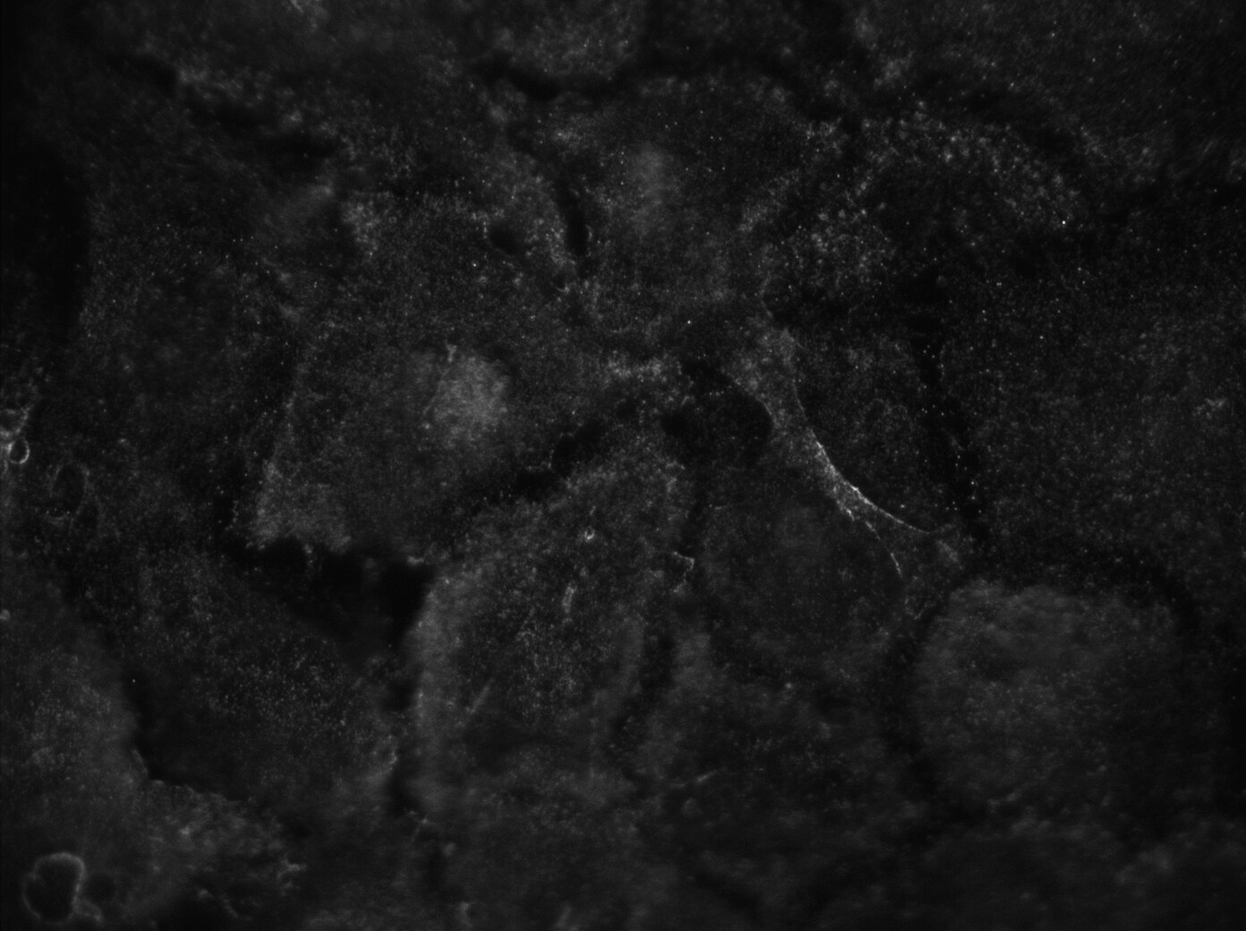 Septin-2 Antibody - BSA Free NBP1-85212