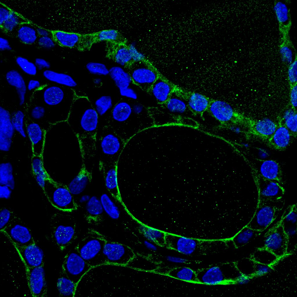 SLC26A4 Antibody - BSA Free NBP1-85237