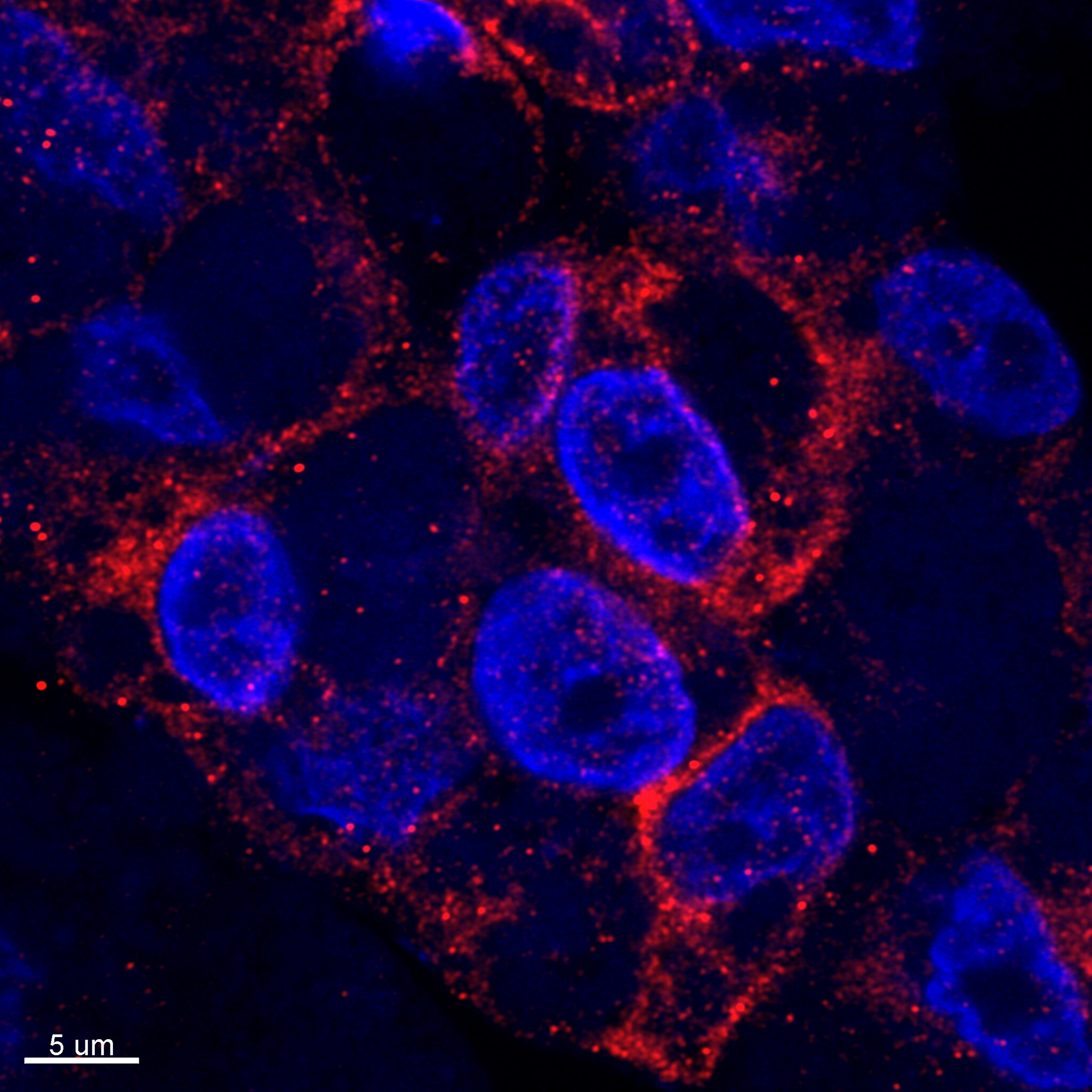 Cytochrome P450 2E1 Antibody - BSA Free NBP1-85367