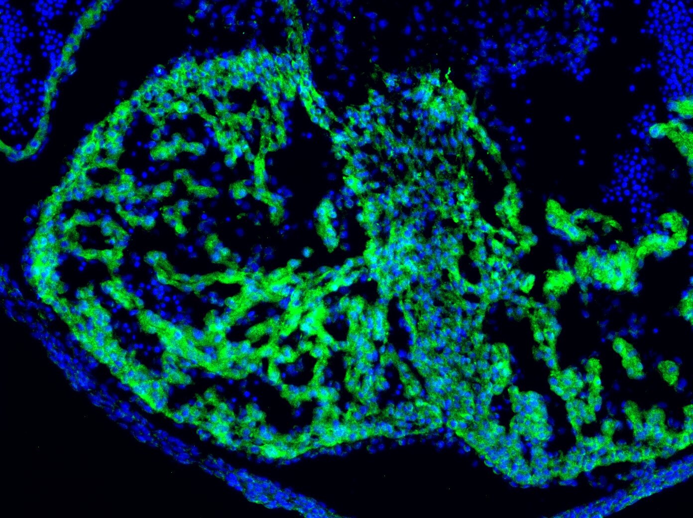 Myosin Light Chain 2 Antibody - BSA Free NBP1-85541