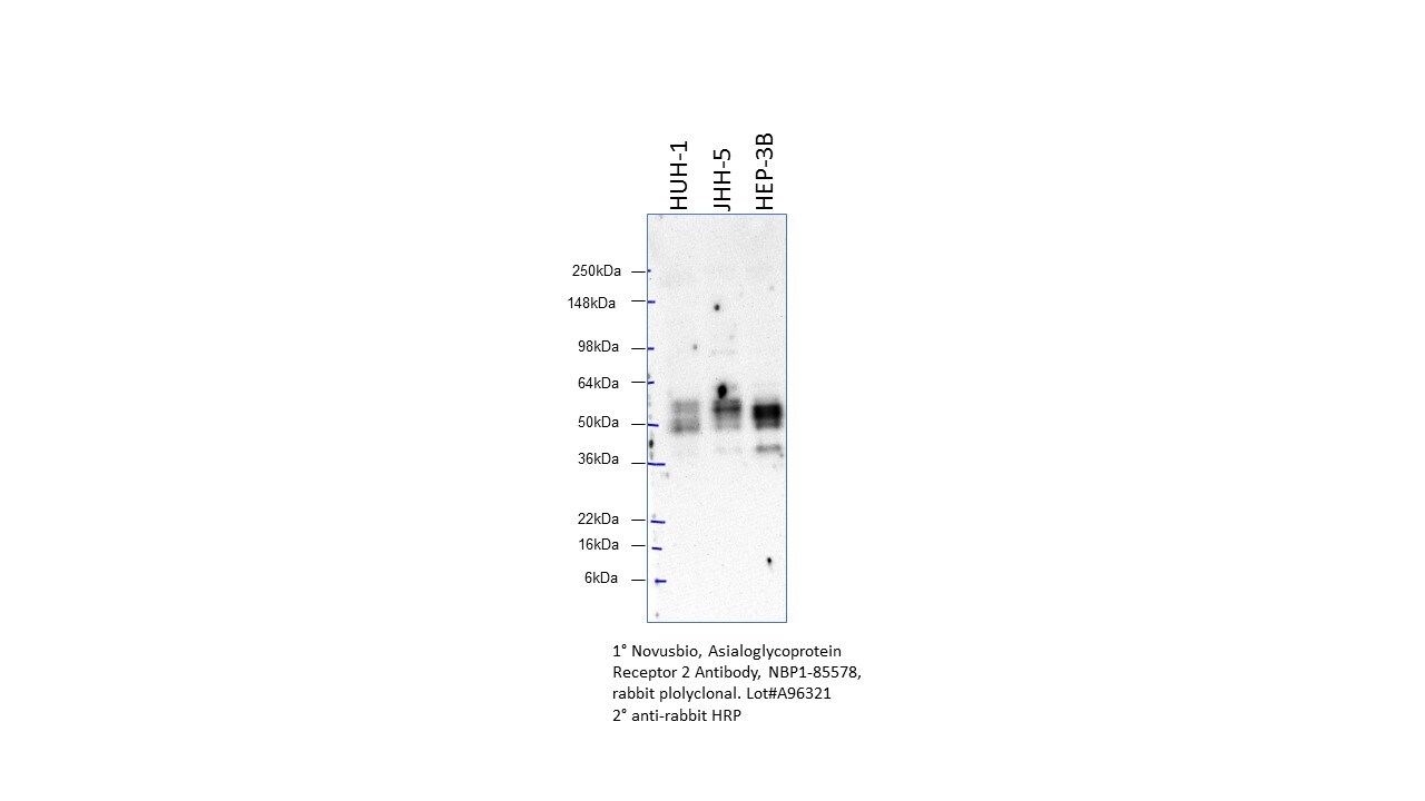 Asialoglycoprotein Receptor 2 Antibody - BSA Free NBP1-85578