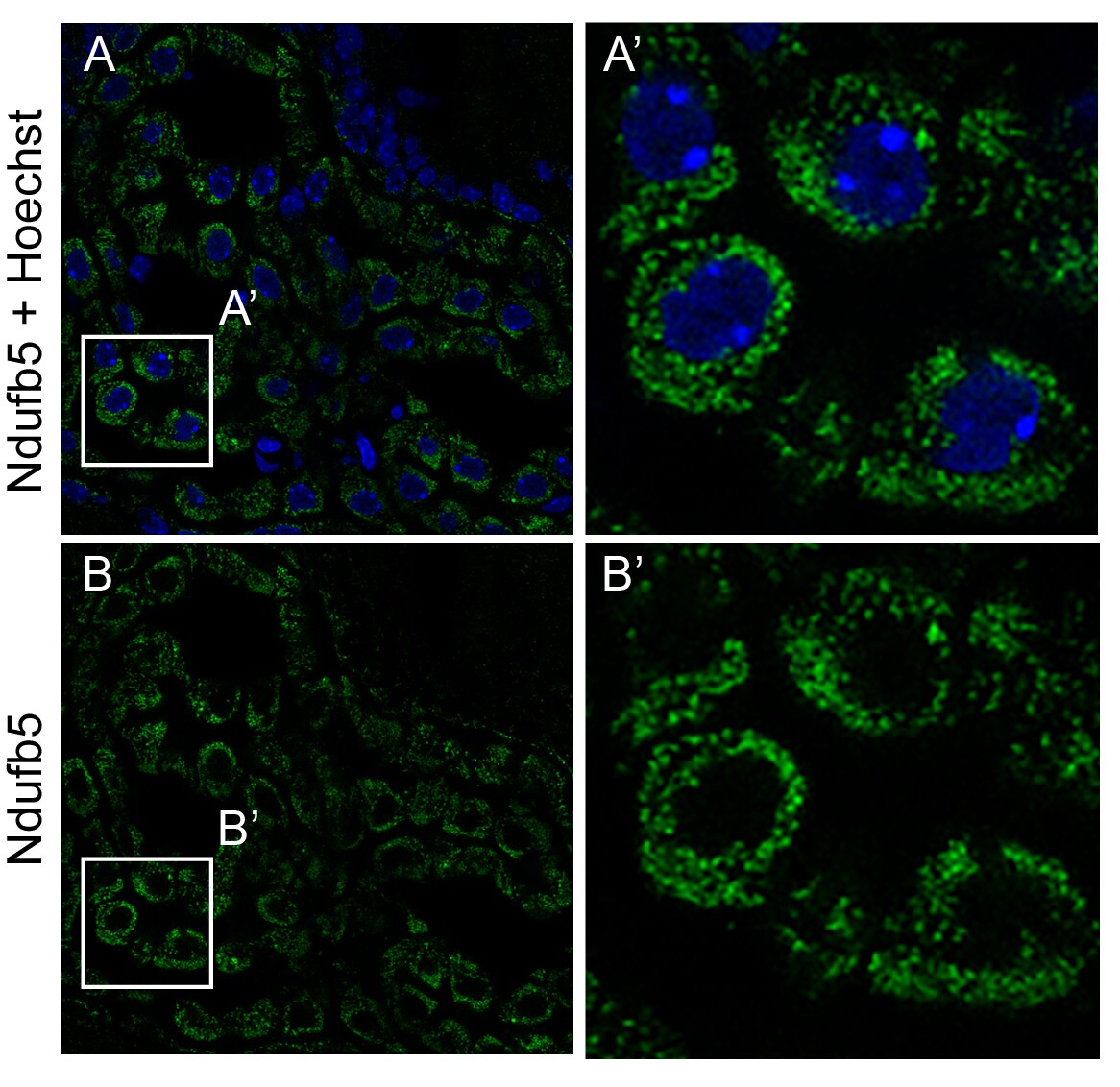 NDUFB5 Antibody - BSA Free NBP1-85607