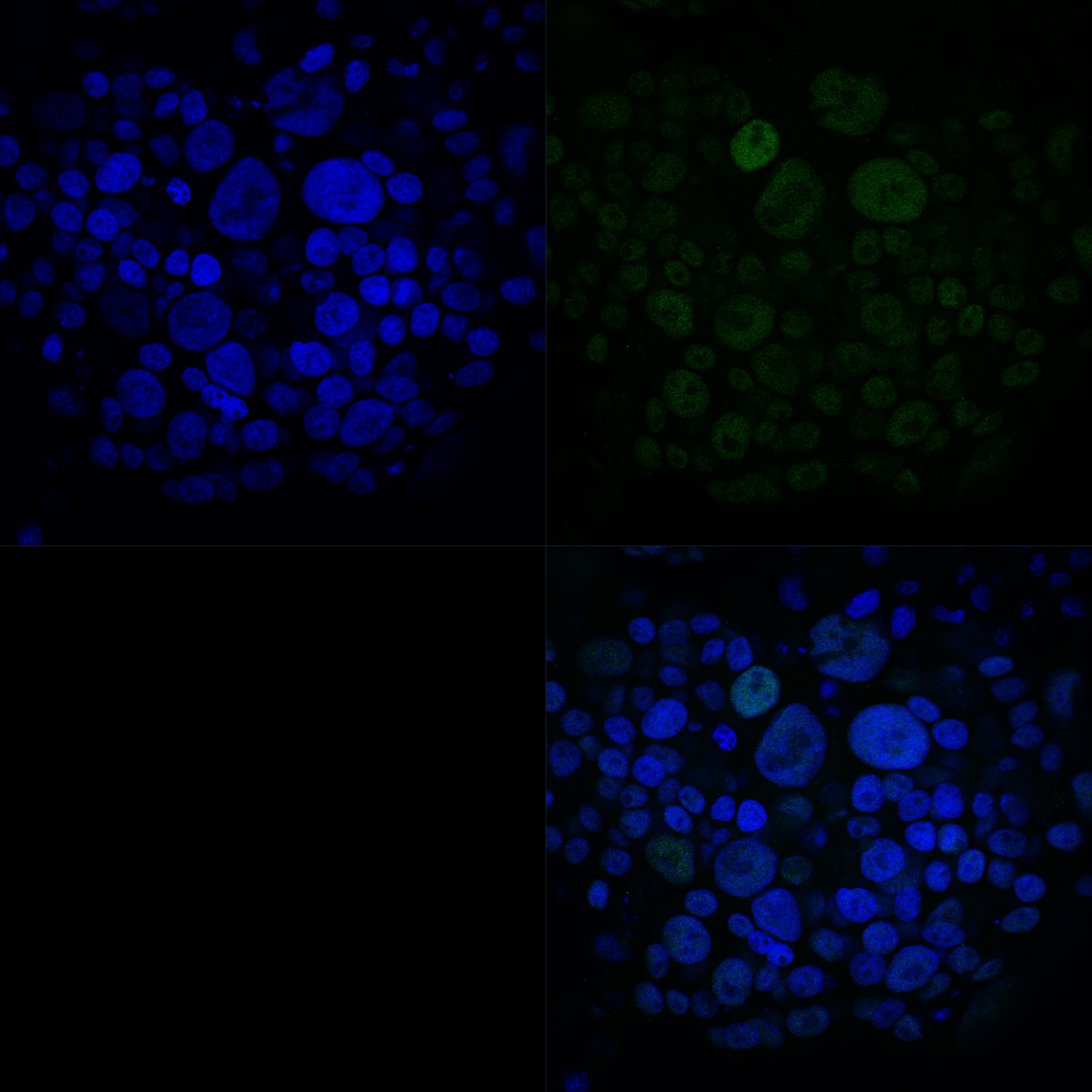 ATF3 Antibody - BSA Free NBP1-85816