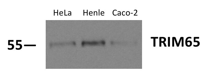 TRIM65 Antibody - BSA Free NBP1-86017