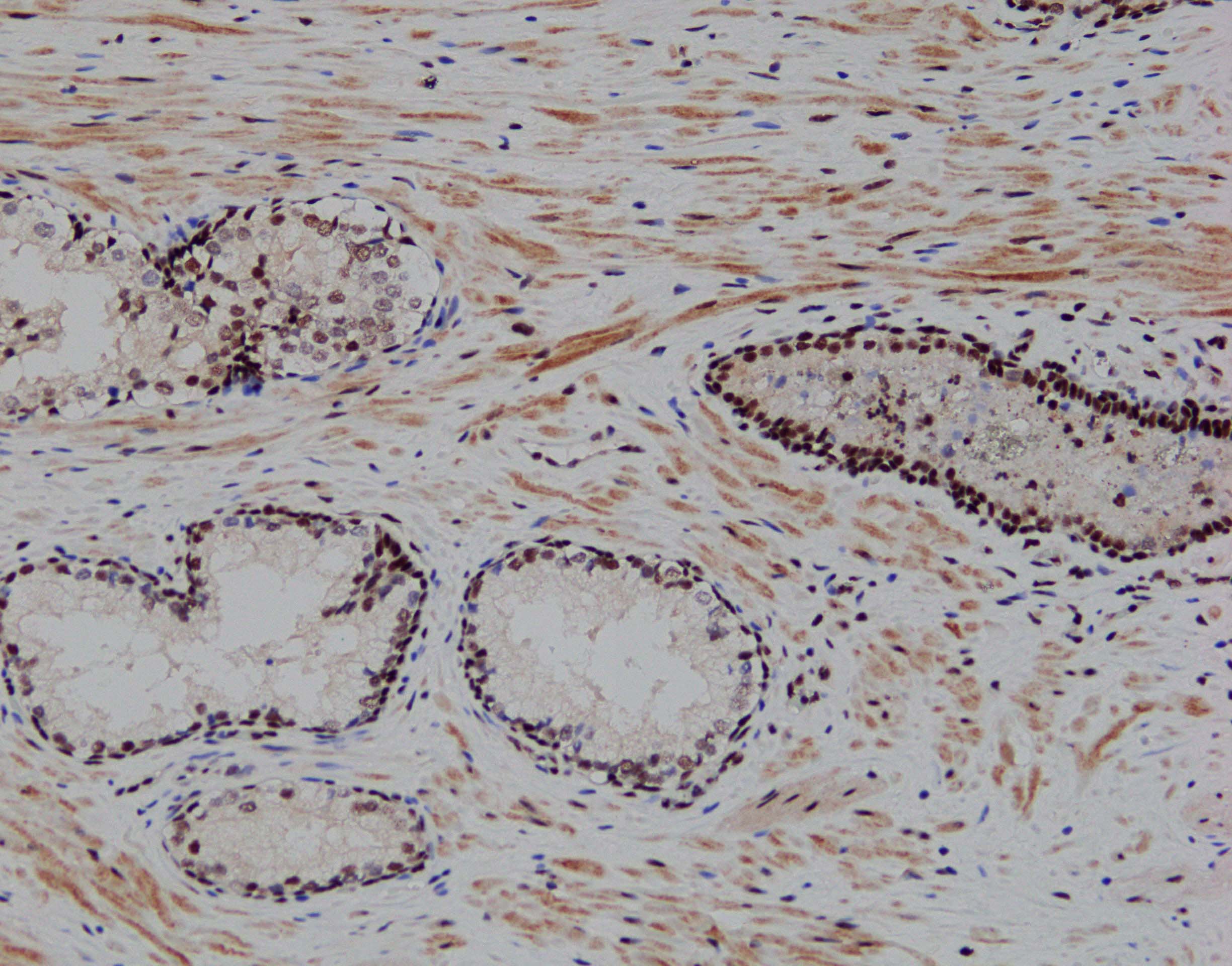 RBM7 Antibody - BSA Free NBP1-86080