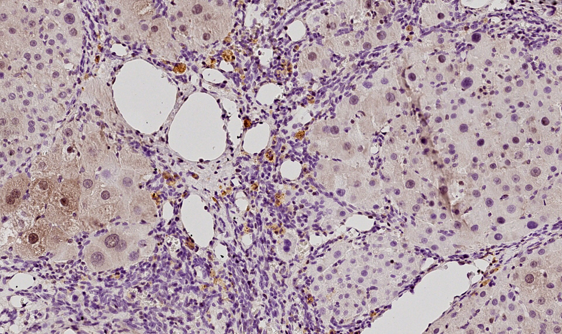 Histamine H2R Antibody - BSA Free NBP1-86082
