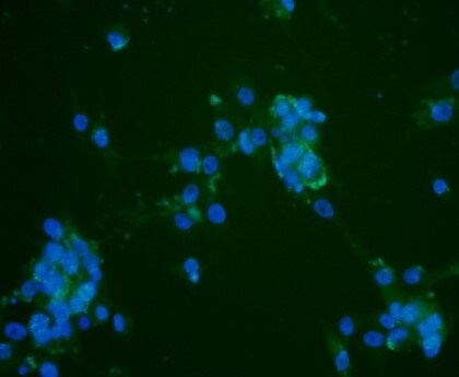 Histamine H2R Antibody - BSA Free NBP1-86082