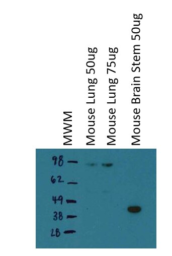 Hyaluronan Synthase 3/HAS3 Antibody - BSA Free NBP1-86328