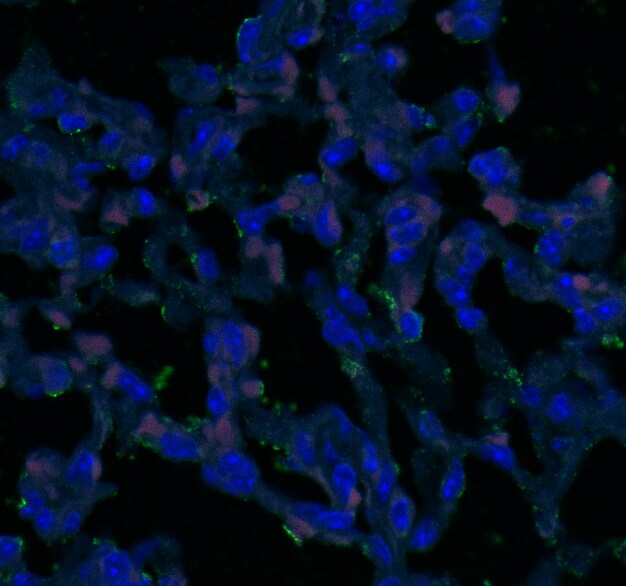 Tight Junction Protein 2 Antibody - BSA Free NBP1-86850